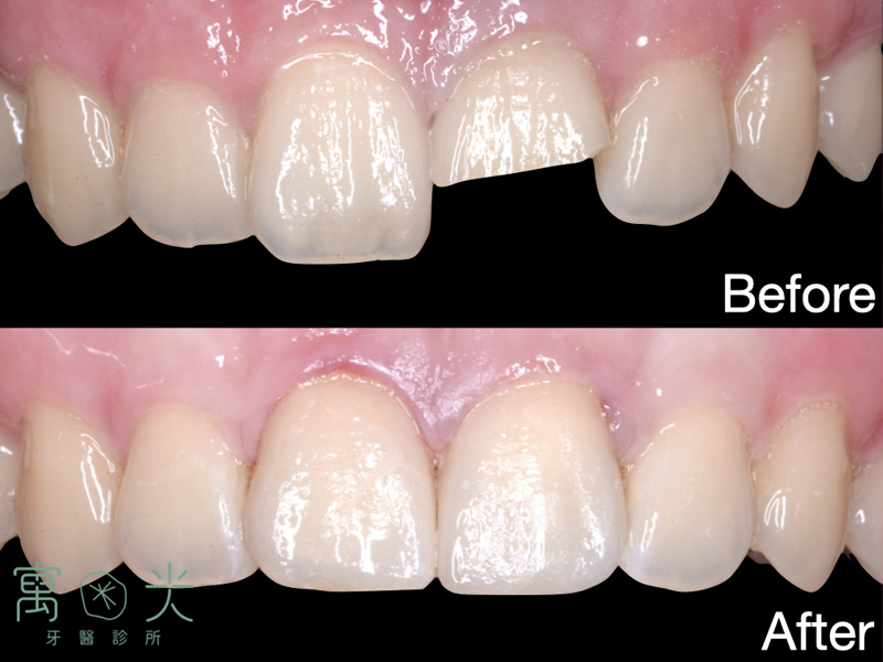 Read more about the article 陶瓷貼片案例